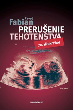 Prerušenie tehotenstva zn. diskrétne